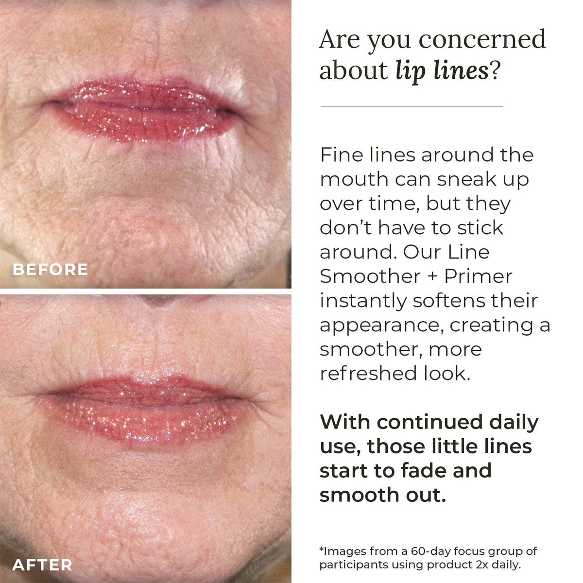 Line Smoother + Primer with Neodermyl® - Shaketea