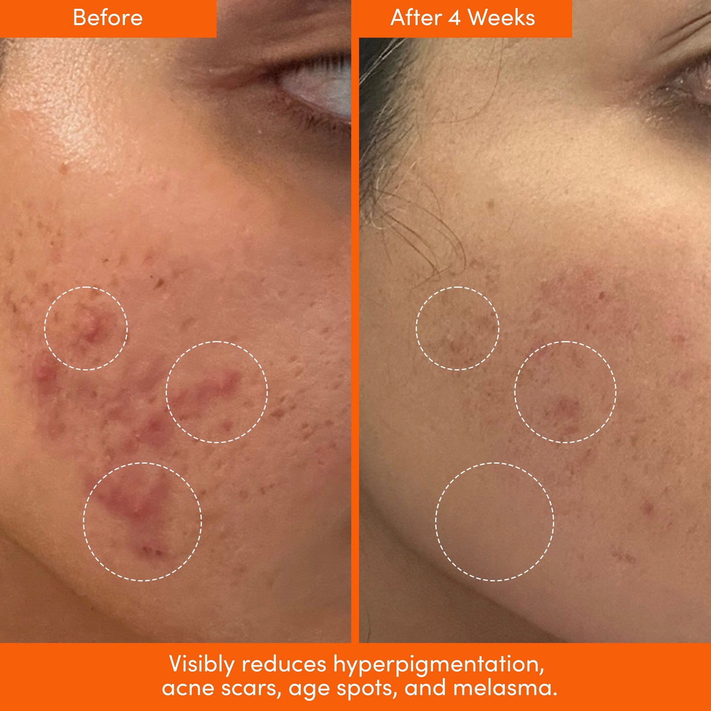 UNSPOTTED 4X® Acid Jelly Night Serum