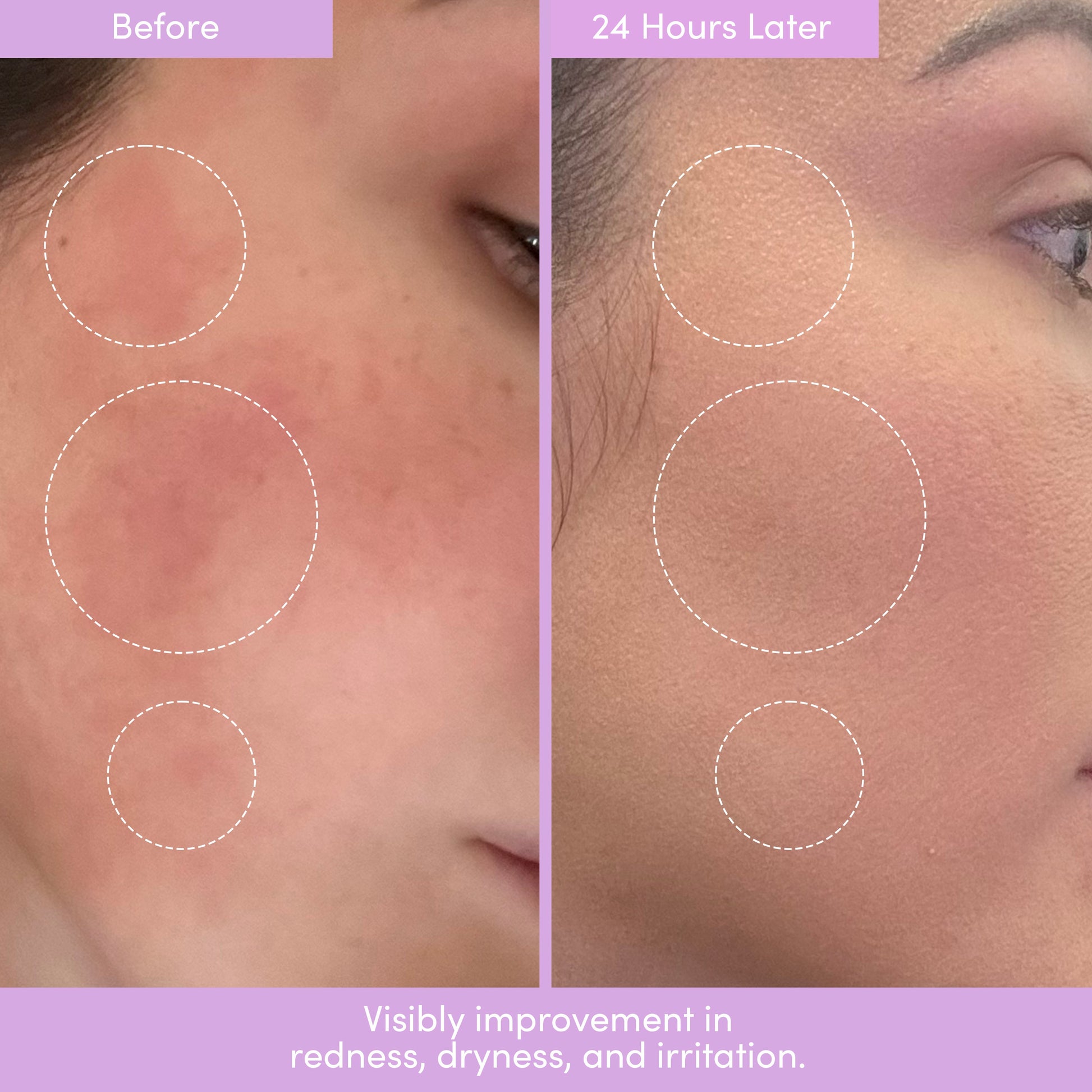 THE PLACENTA FACIAL Dark Spot Serum + Barrier Repair Cream Bundle - Shaketea