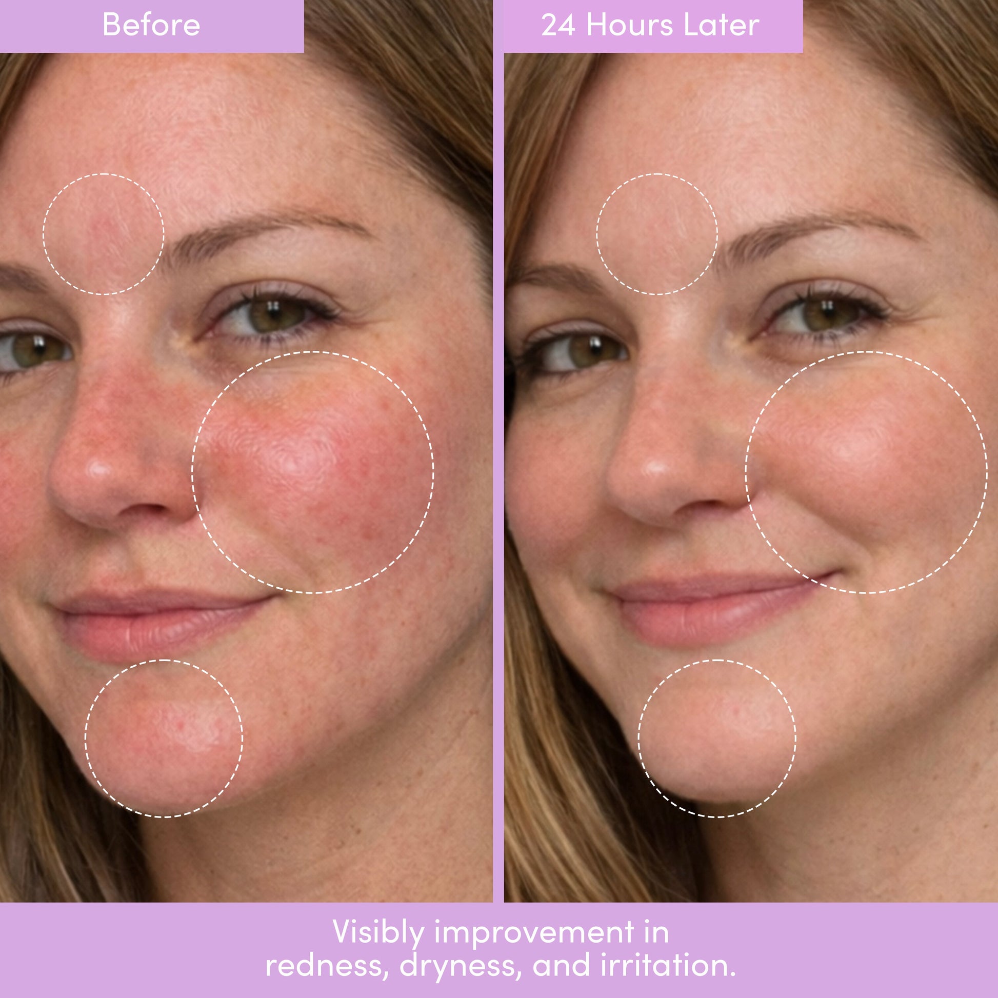 THE PLACENTA FACIAL Dark Spot Serum + Barrier Repair Cream Bundle - Shaketea