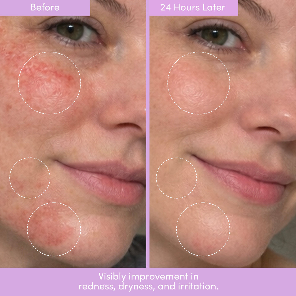 THE PLACENTA FACIAL Dark Spot Serum + Barrier Repair Cream Bundle - Shaketea
