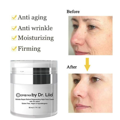 Gentle Retinol Night Cream for Sensitive Mature Skin – Wrinkle Repair Without Irritation