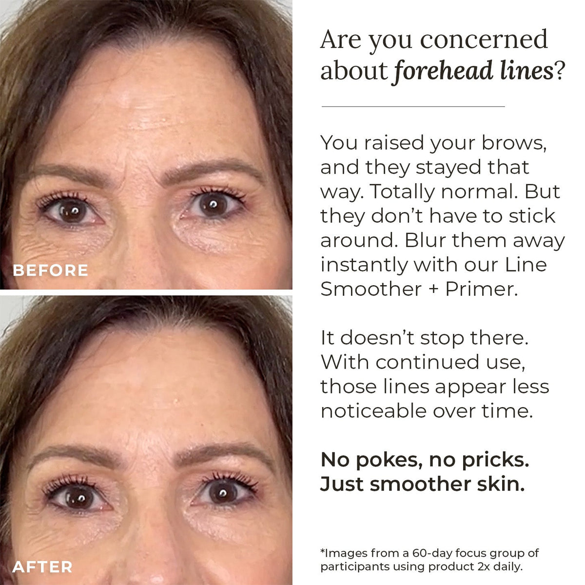 Line Smoother + Primer with Neodermyl® - Shaketea