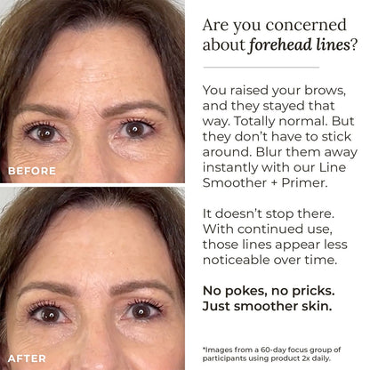 Line Smoother + Primer with Neodermyl® - Shaketea