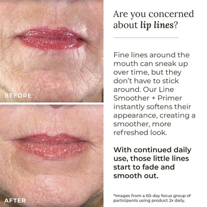 Line Smoother + Primer with Neodermyl® - Shaketea