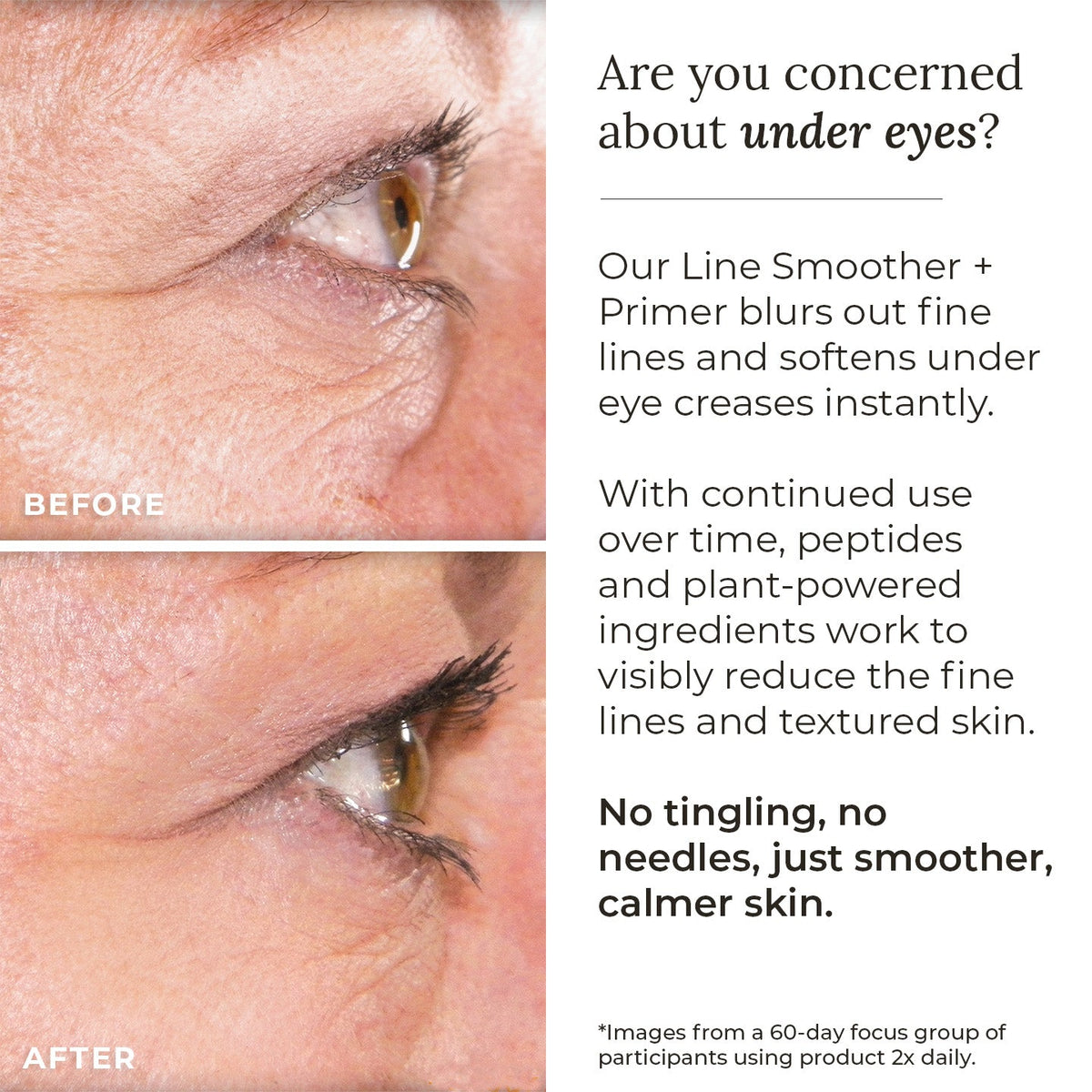 Line Smoother + Primer with Neodermyl® - Shaketea