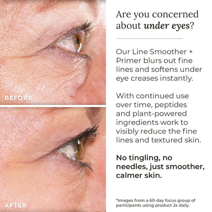 Line Smoother + Primer with Neodermyl® - Shaketea