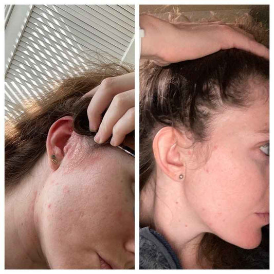 GoodBiome®️ Prebiotic Facial Solution: Liquid AHA + BHA Serum
